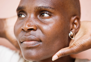 Are You Considering Hair Restoration and Transplants? Read This