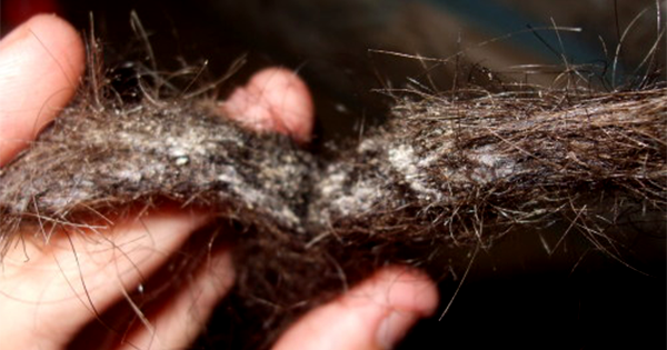 Remove Mildew Smell >> How to Avoid Mildew in Your Hair (and How to Remove It) Remove Mildew Smell >> How to Avoid Mildew in Your Hair (and How to Remove It)